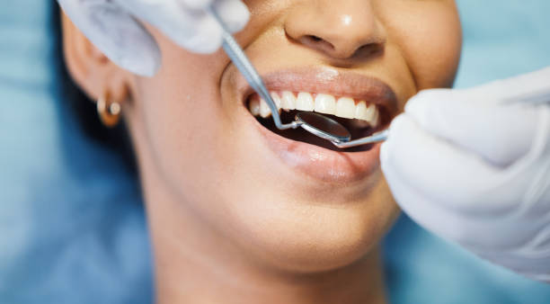 Best Knocked-Out Tooth Emergency  in Hudson, IL